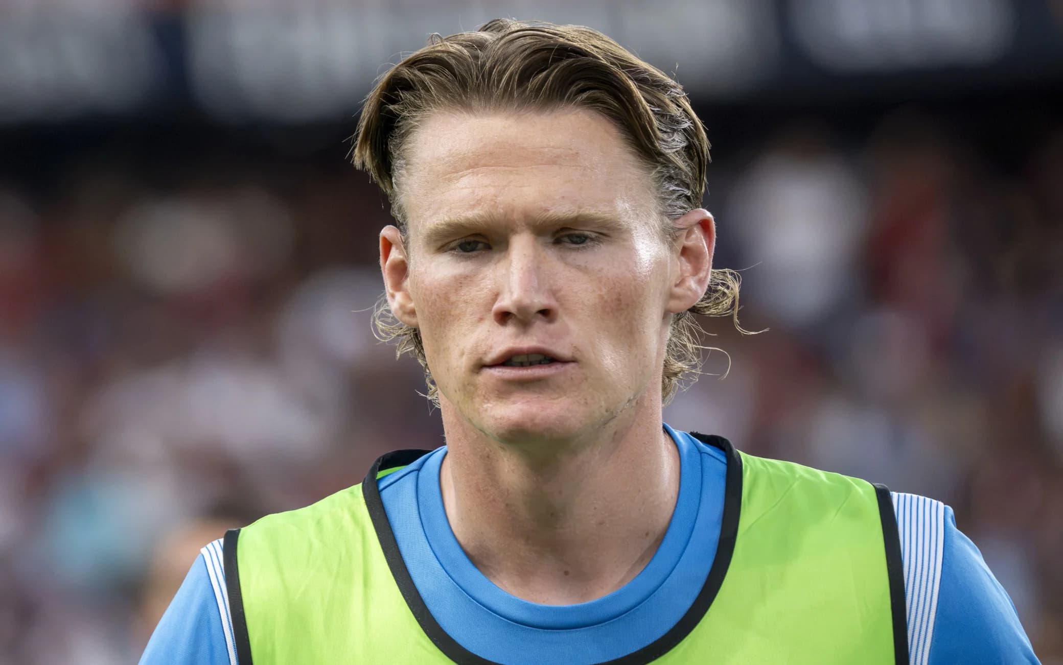 Napoli, McTominay: intervento di ablazione riuscito. A riposo per circa due settimane